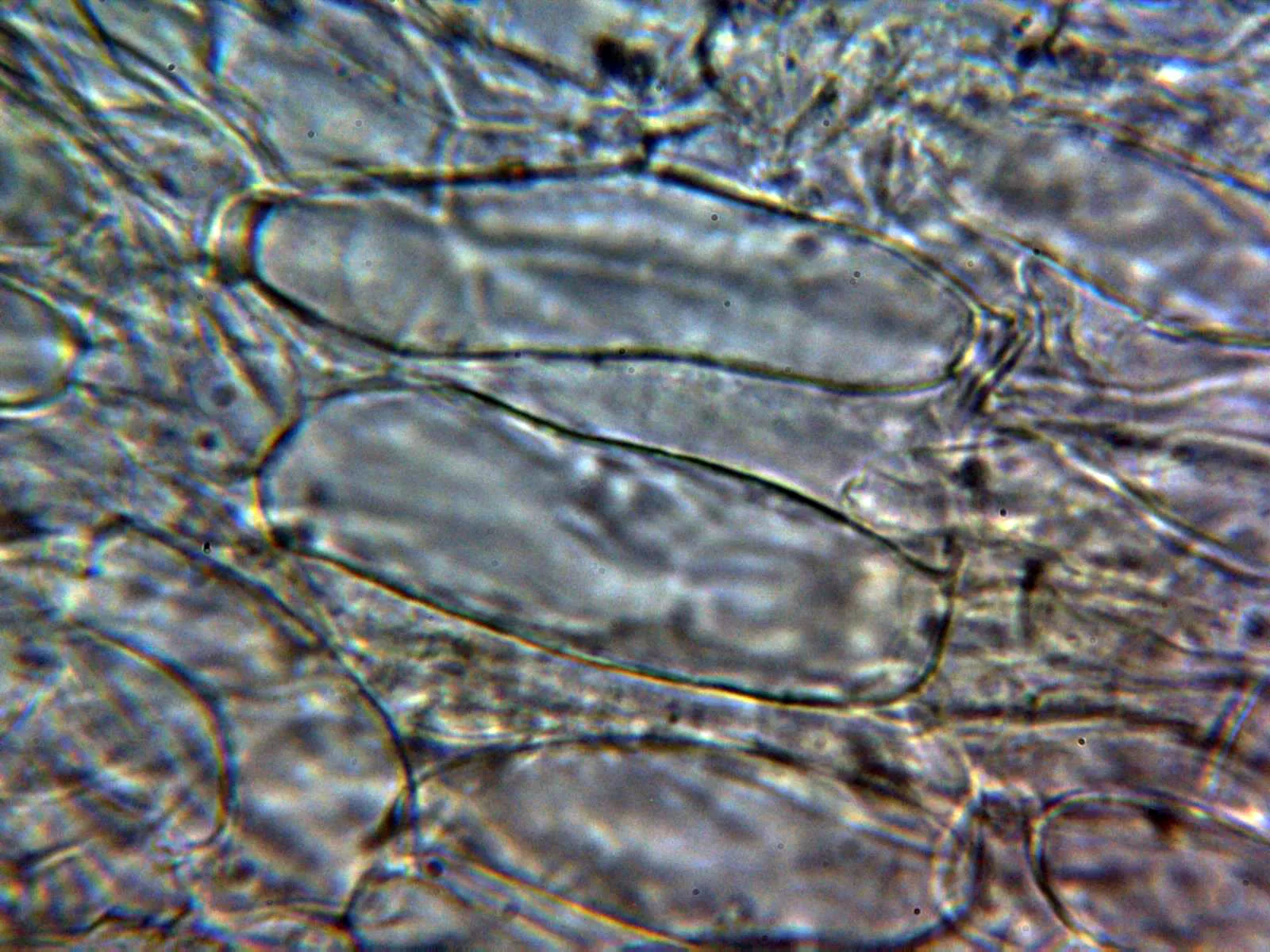 Microscopía de Mycena dura - 10 - Pileipellis agua 2